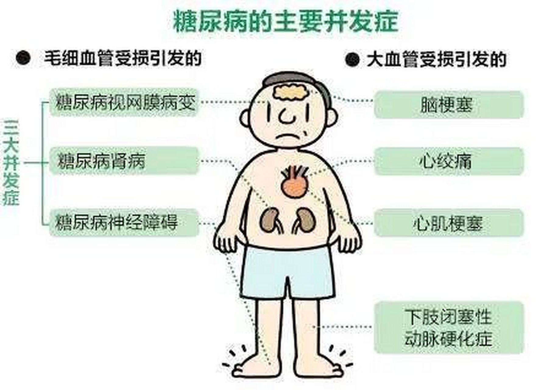 《干细胞》糖尿病并发症的克星  糖尿病的并发症危害非常大,当出现