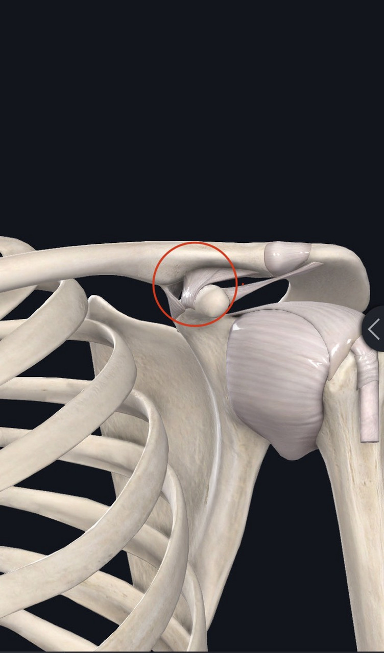 肩锁韧带断裂图片