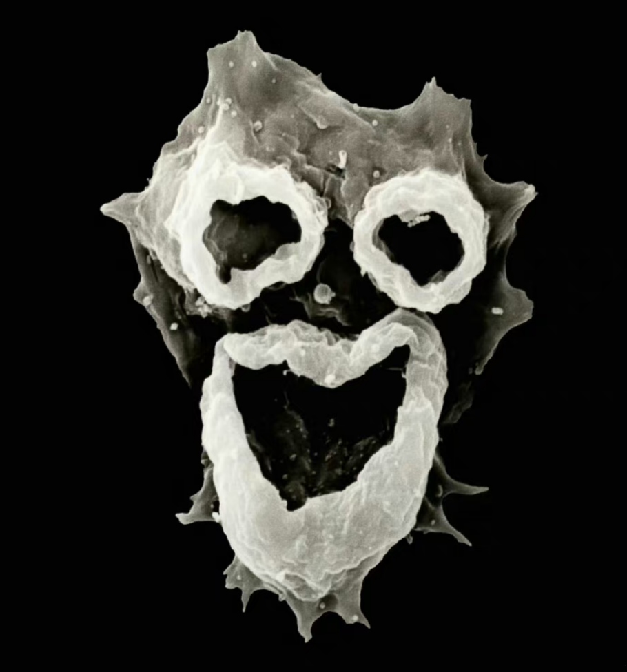 原名阿米巴原虫,它们通常生活在温暖的淡水和土壤中,常见于25°c