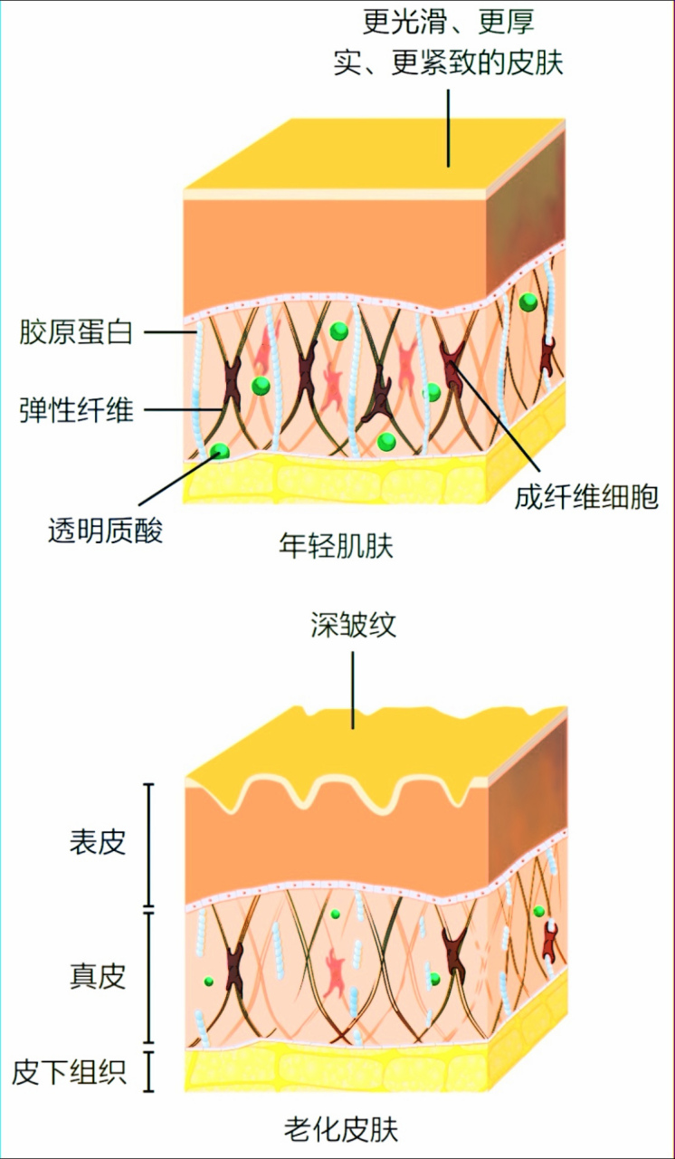 表皮,真皮和皮下组织共同构成我们的皮肤整体,随着时间的流逝,岁月会
