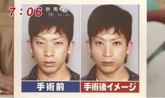 日本最帅罪犯:逃亡两年三次整容,被捕后因太帅被无数少女当偶像