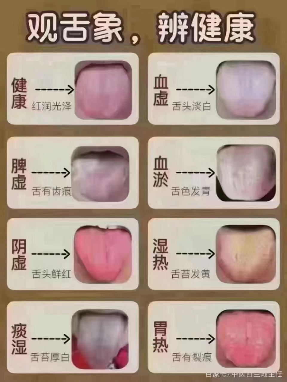 舌诊入门歌 望舌诊病有诀窍,五脏六腑与三焦; 整体局部相结合,再看