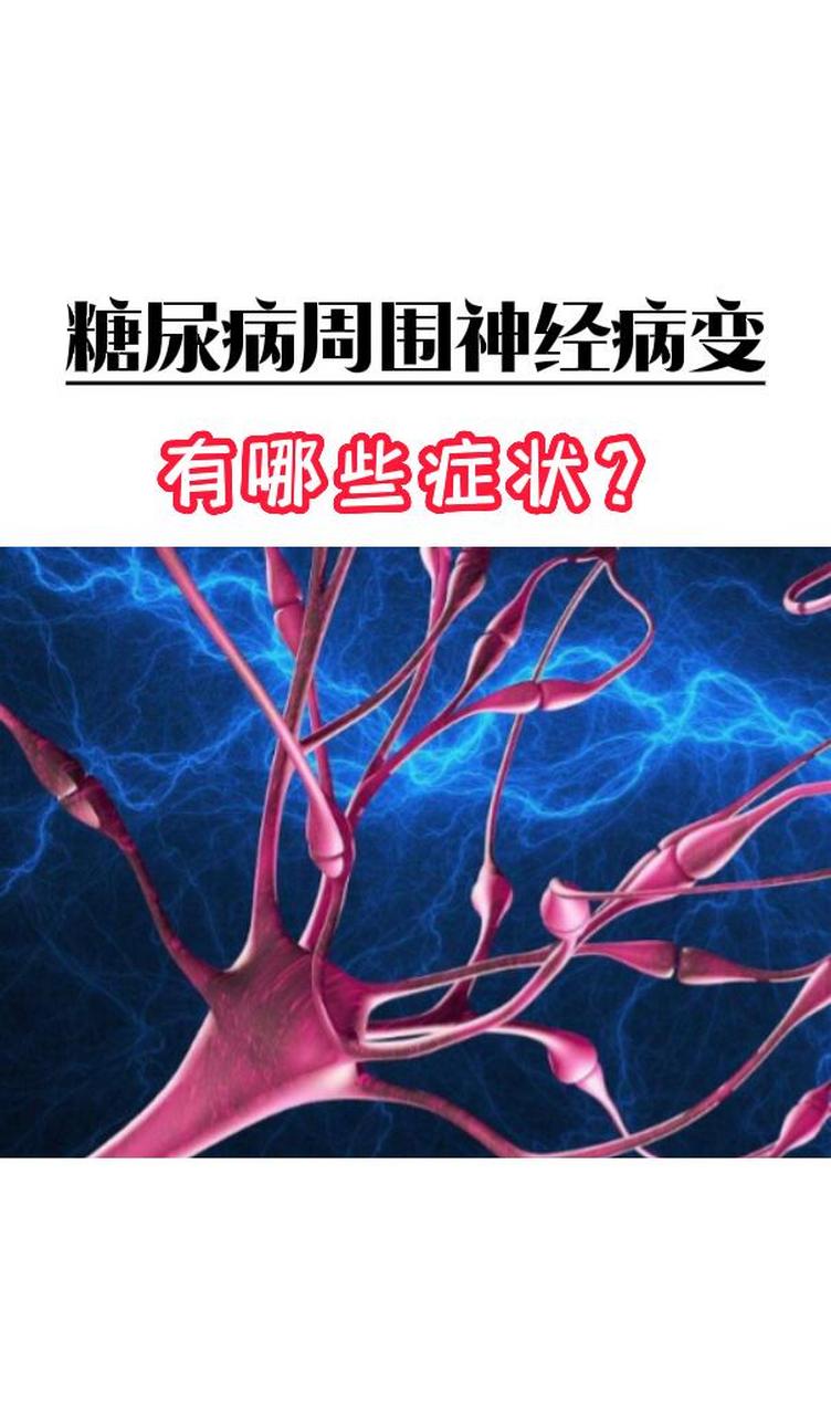 糖尿病周围神经病变又哪些症状? 关于糖尿病神经病变.首先,它分为:糖