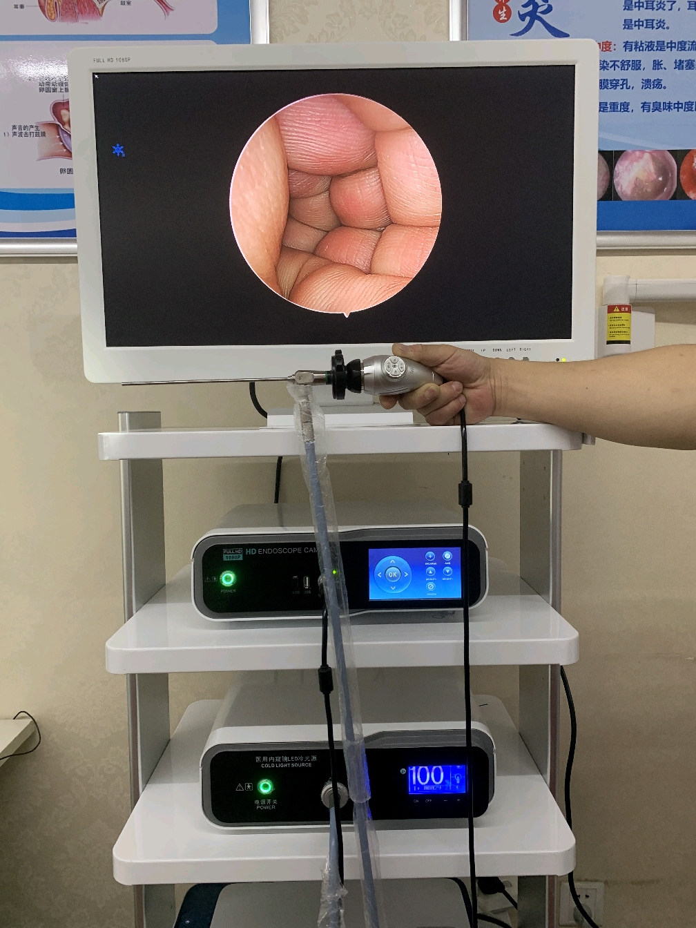 可视采耳设备可视采耳仪器可视掏耳机器可视采耳培训