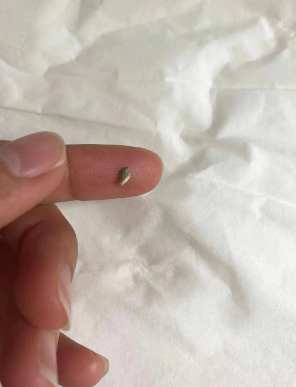 牙黄口臭去了一趟口腔科,开了这两个东西把牙结石洗掉了,嘴里也不臭了