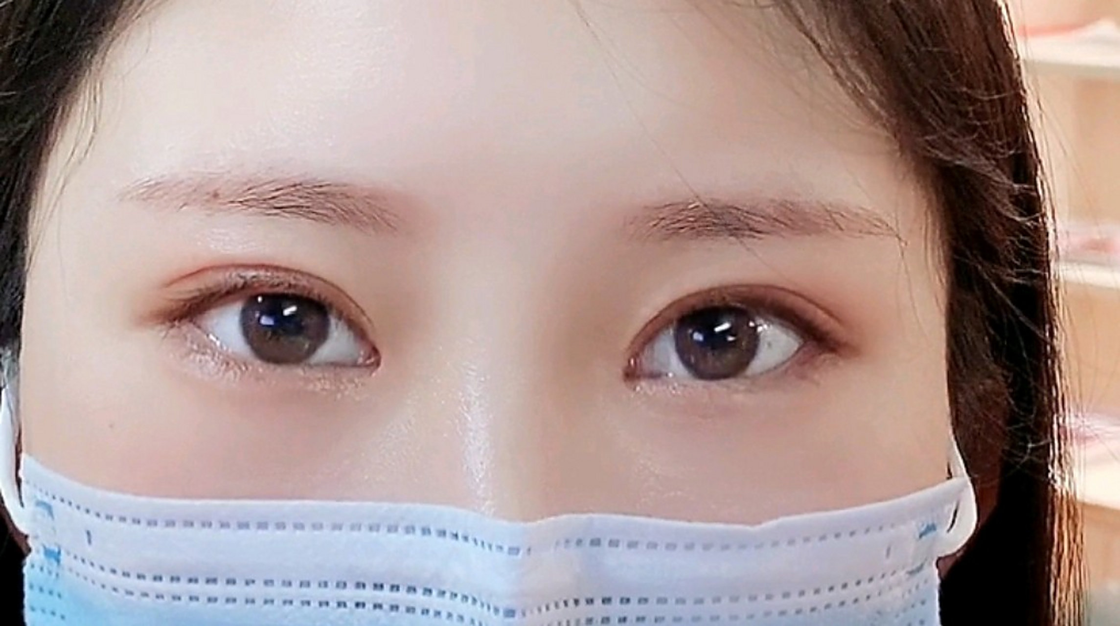 一般是1cm以上的双眼皮适合于面型长方和眉弓高的人,东方人一般不适合