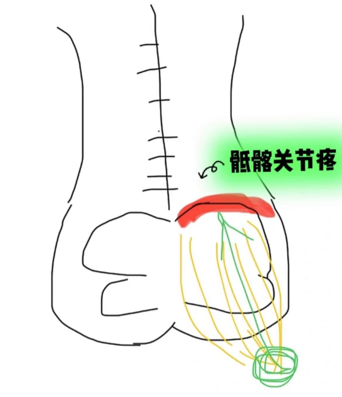 女性骶髂关节位置图片图片