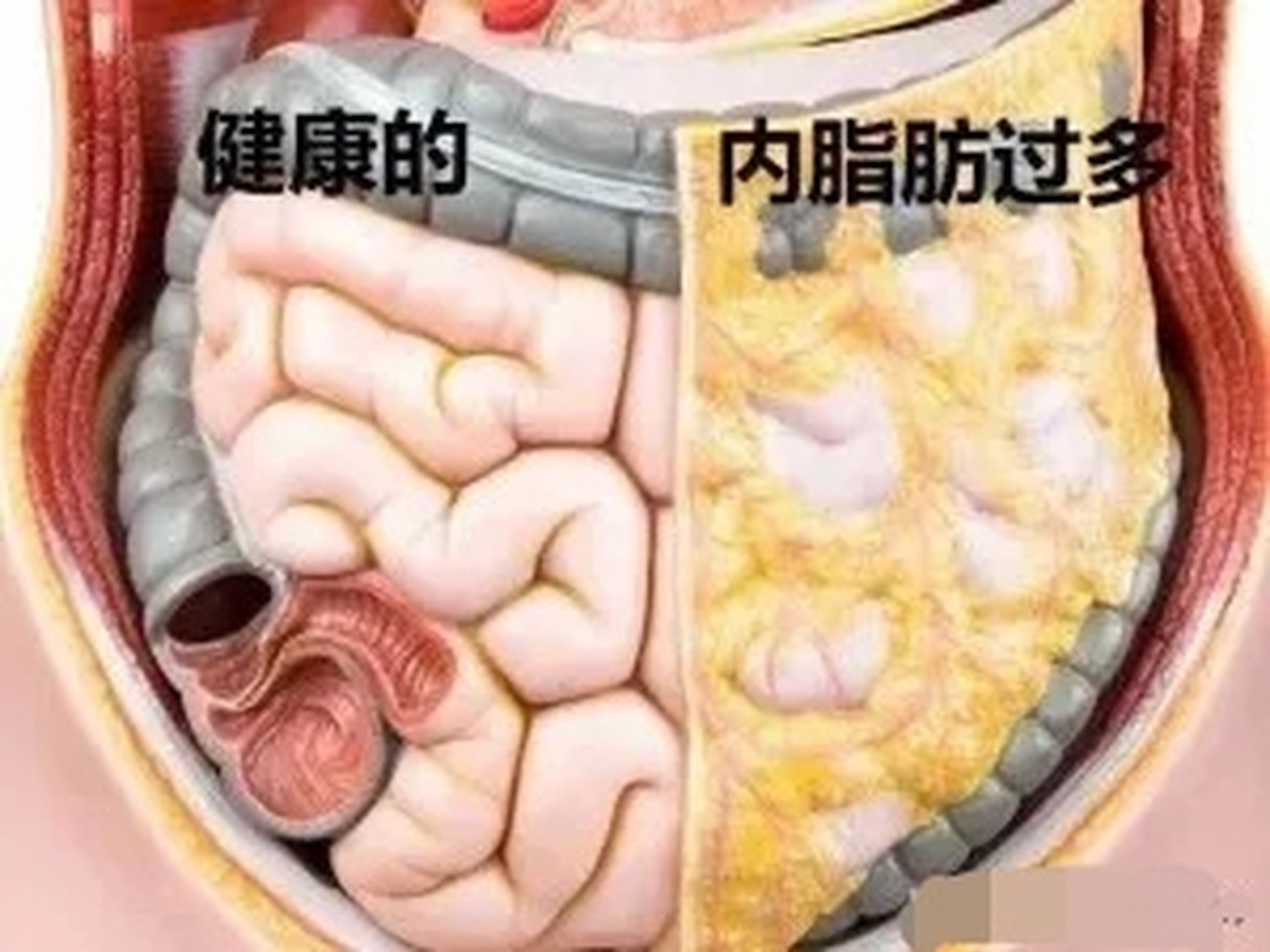 自测内脏脂肪是否超标#人体在贮藏皮下脂肪的同时,也会同时存下内噜