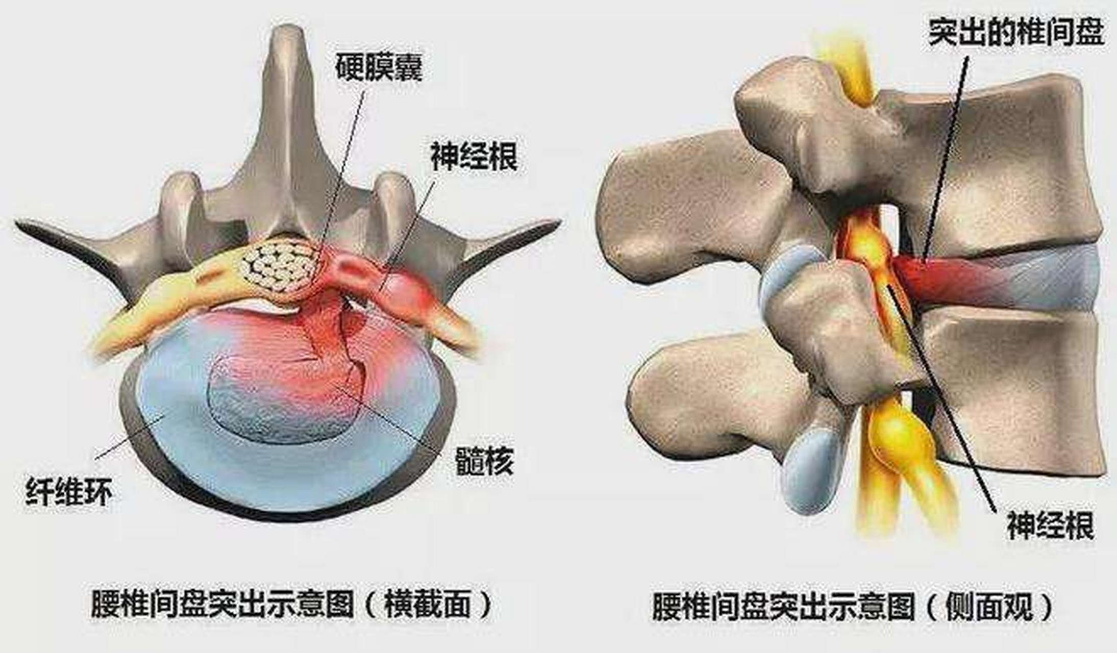 颈椎神经根分布图图片