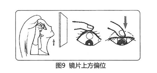 角膜塑形镜偏位处理方法