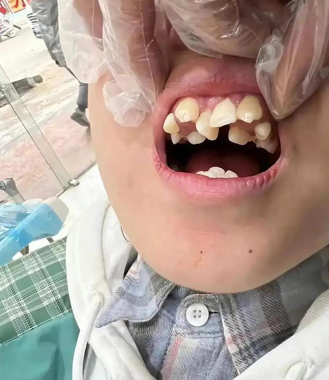 这是长了三排牙齿吗?给咬一下还得了吗?