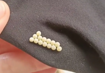 深圳女子衣服上发现白色小颗粒,网友认为是虫卵,该如何避免?