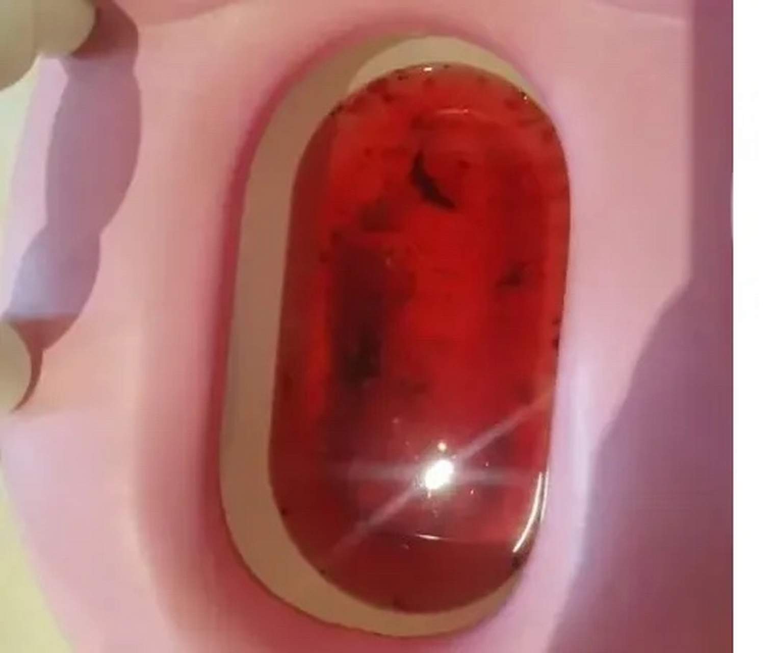 我宝贝女儿今年7岁,早上我发现她小便没冲厕所,我一看,尿液是红色的