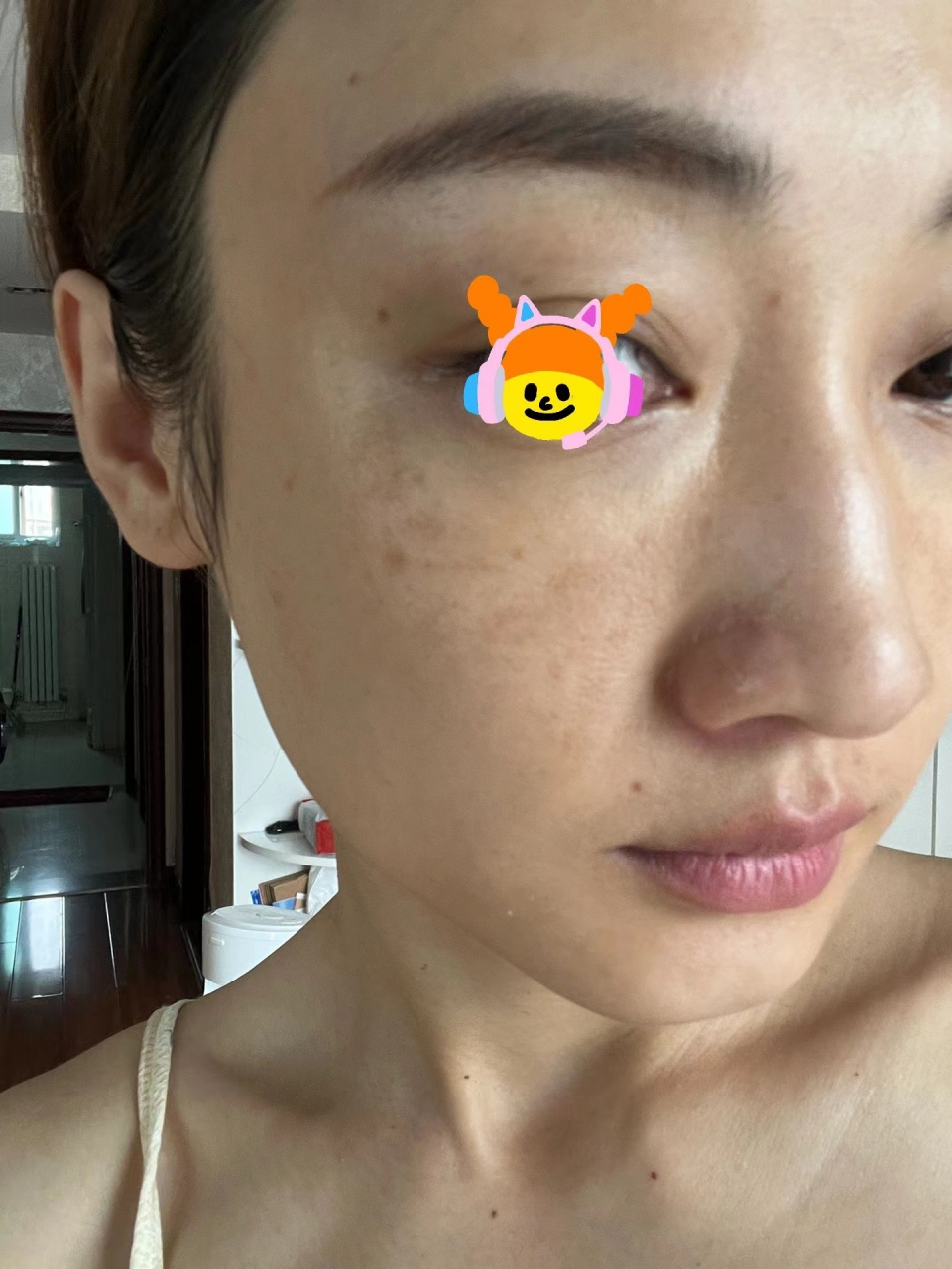 一大早看见自己脸上的黄褐斑连睡意都没有了!