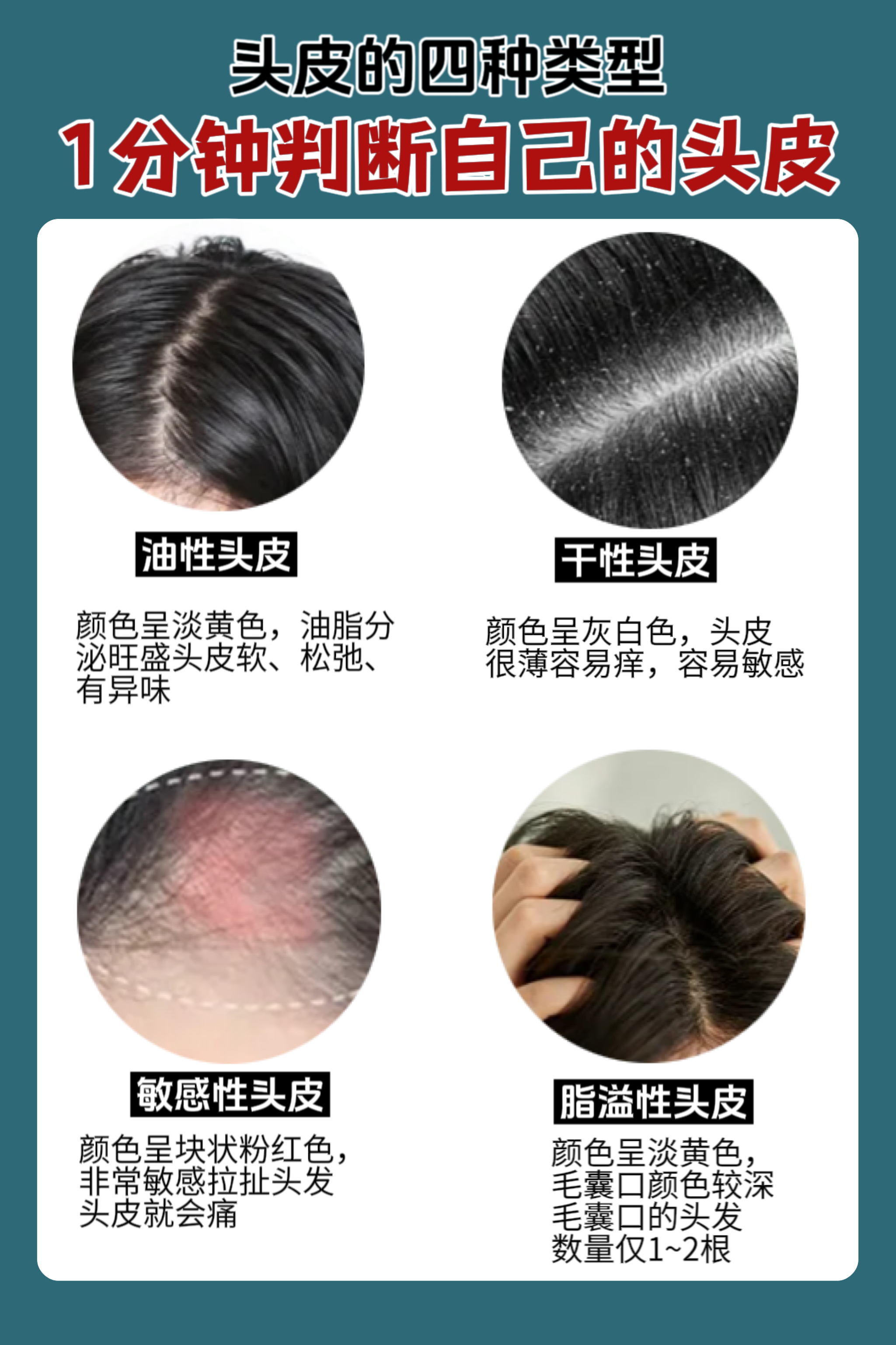 关注头皮健康头发油头屑多头皮痒的看过来头皮的四种常见类型