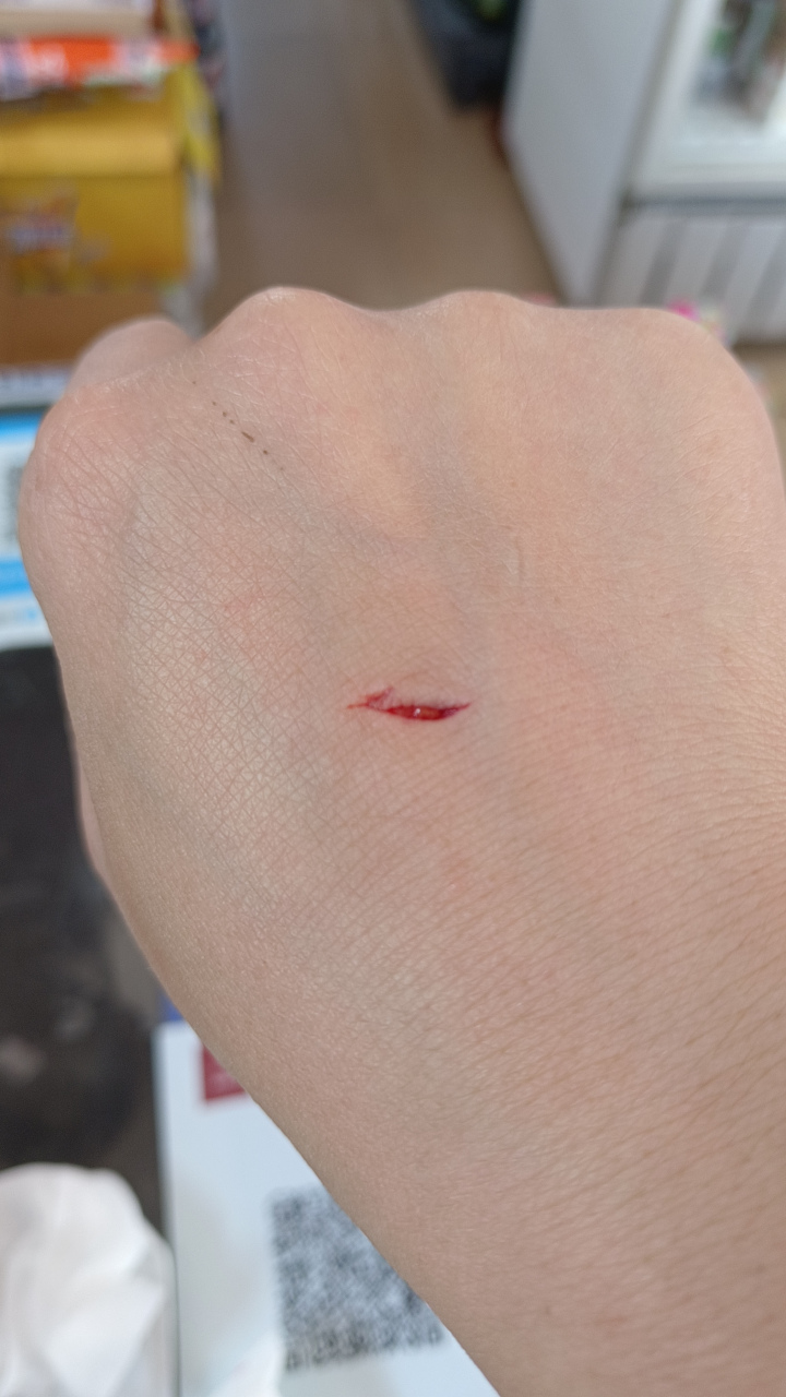 今天干活把手给划破长口子😫吓到我了[大哭]我一