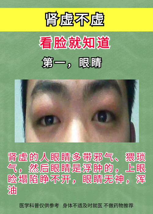 判断自己肾虚很简单,看看自己脸就明白#失眠