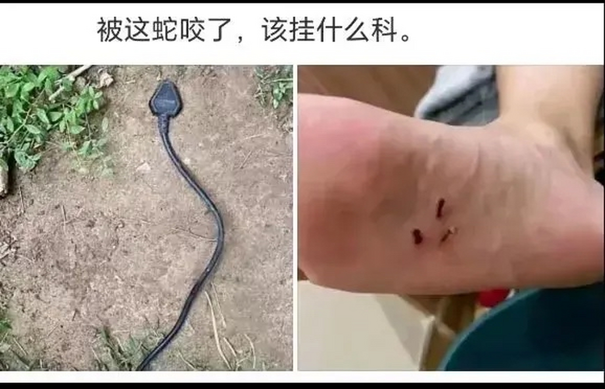 被蛇咬了有什么症状图片