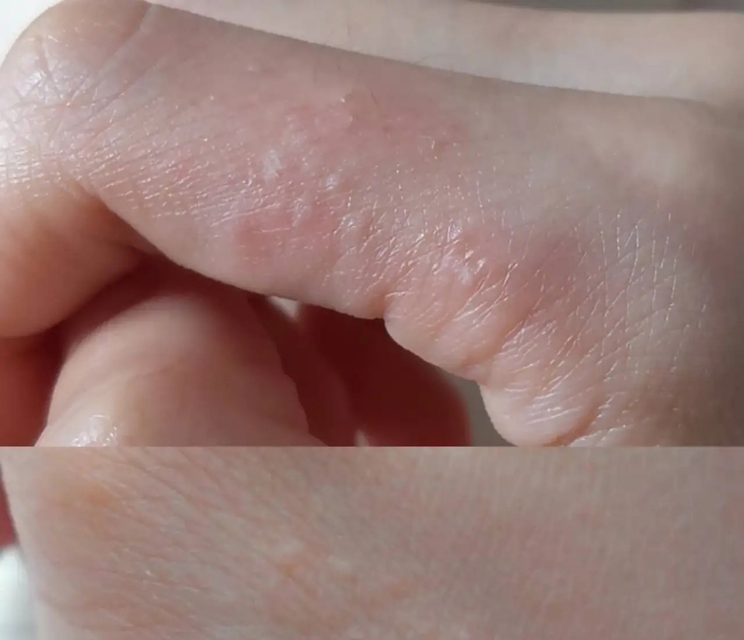 我一听,说"我手上也有!"  "每年都是这个时候起,其他时间没有.