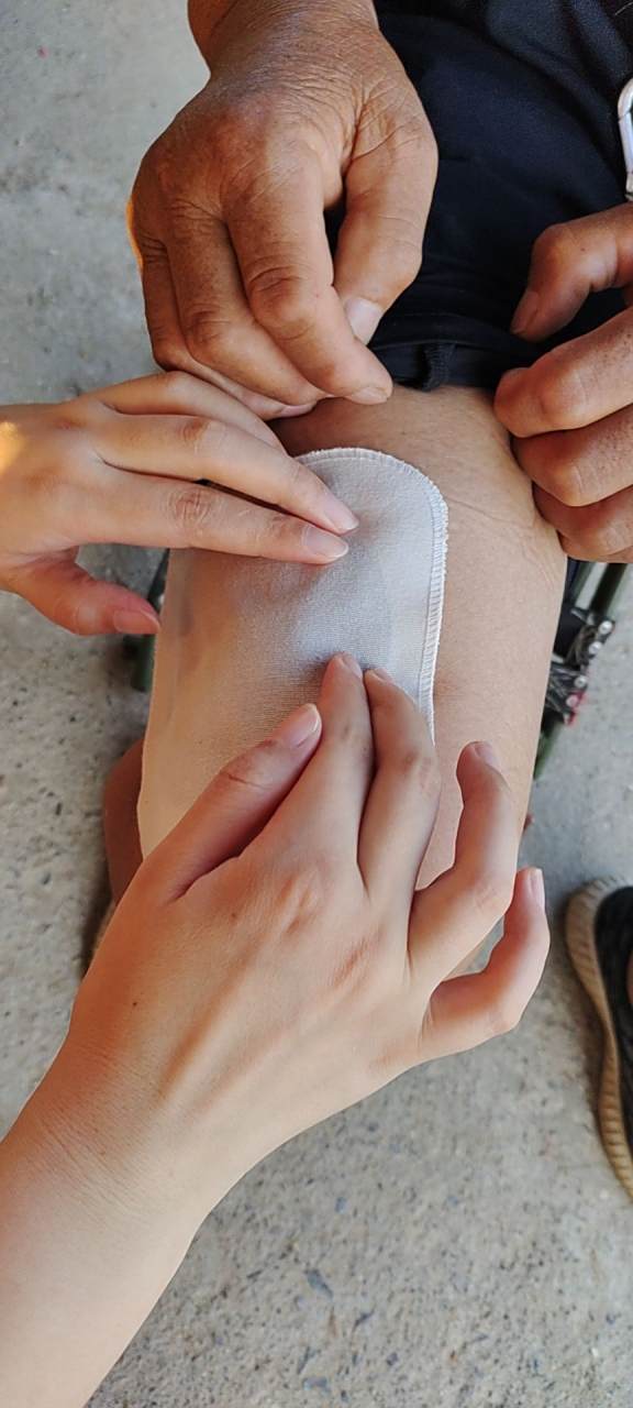 膏药贴敷示意图～腿疼贴敷示意图