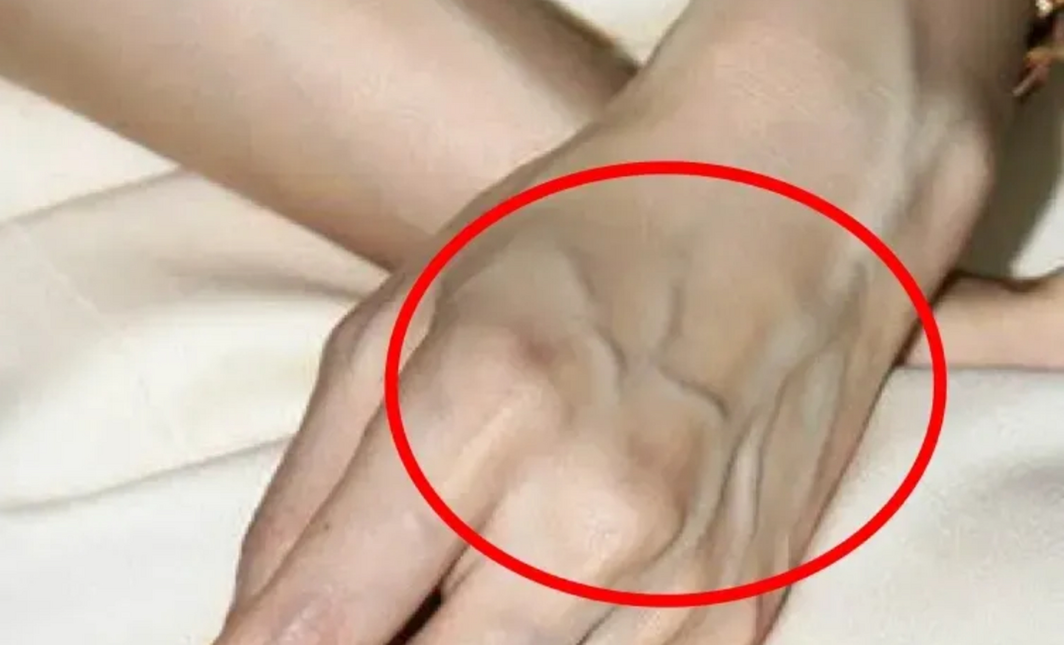 一眼望去,手上青筋暴起,看着很显眼,很不美观.