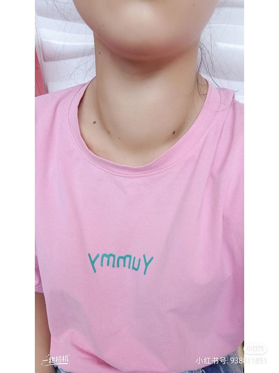 甲亢好了! 再见,心慌,手抖,大脖子