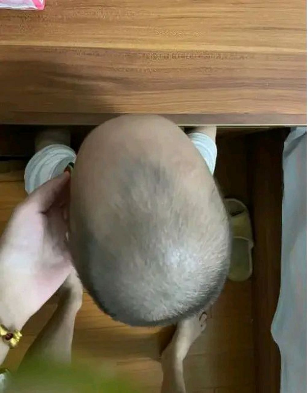 24岁的沈小姐,生下孩子后,一家人发现孩子的头比较尖.