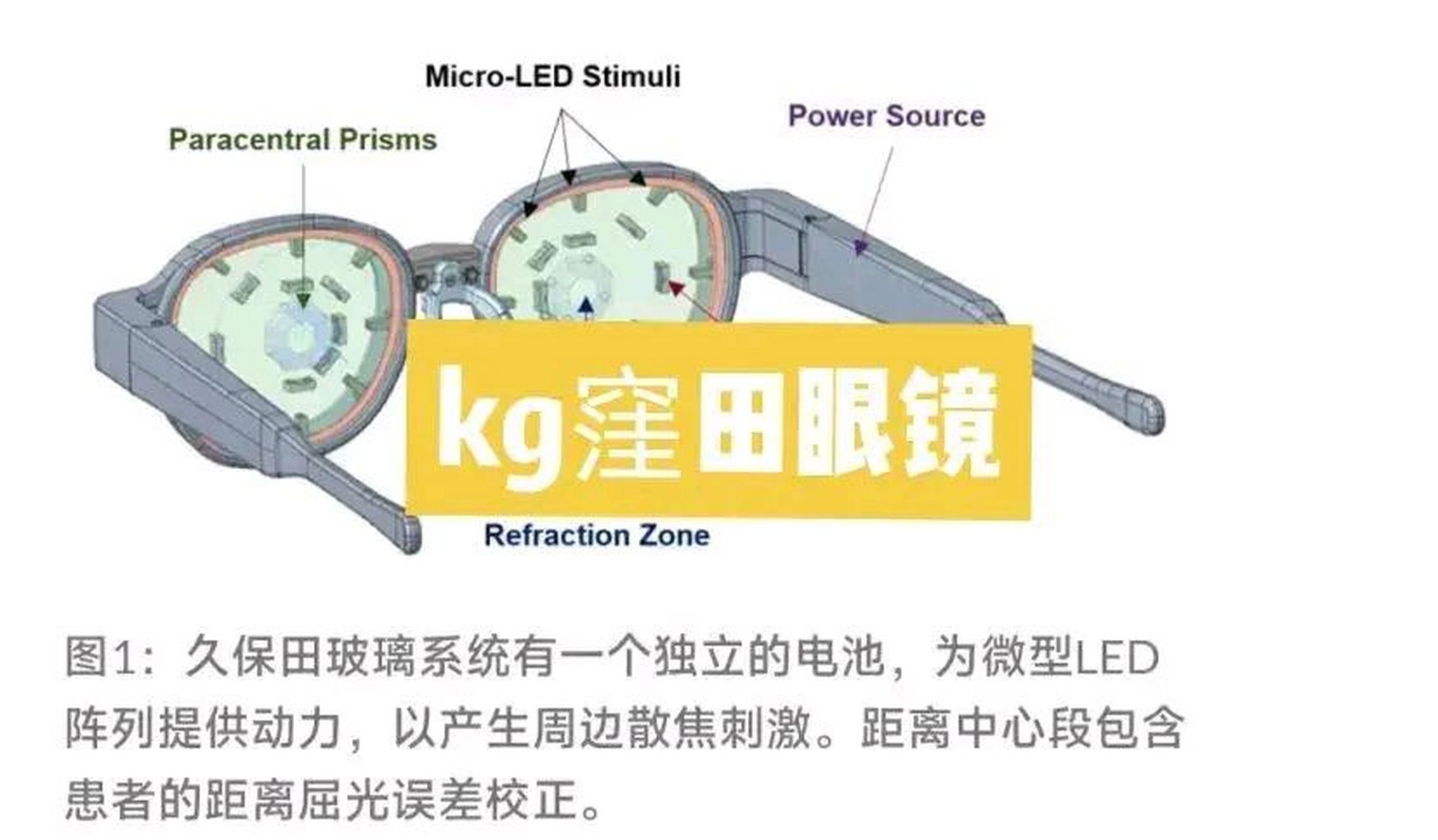 根据日本媒体报道,日本洼田制药研发的这种叫做"洼田眼镜"镜头的中哪