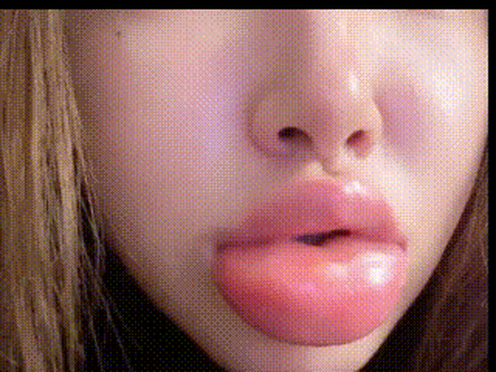 网络上一女子吃田螺嘴肿成这样了,不知道这个是过敏了,还是田螺含有