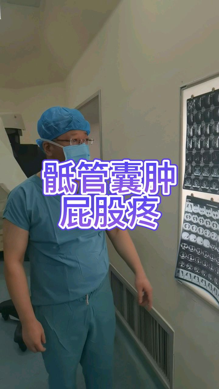 屁股疼痛原来是骶管囊肿惹的祸