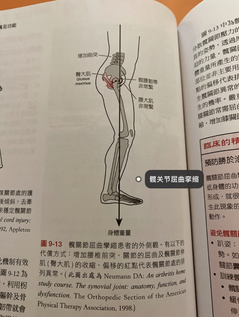 髋关节屈伸示意图图片