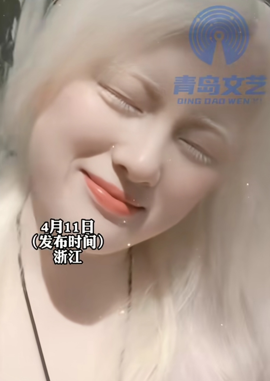 白化病女孩晒出美照微笑,"我觉得我自己笑起来很好看,他们说我笑起来