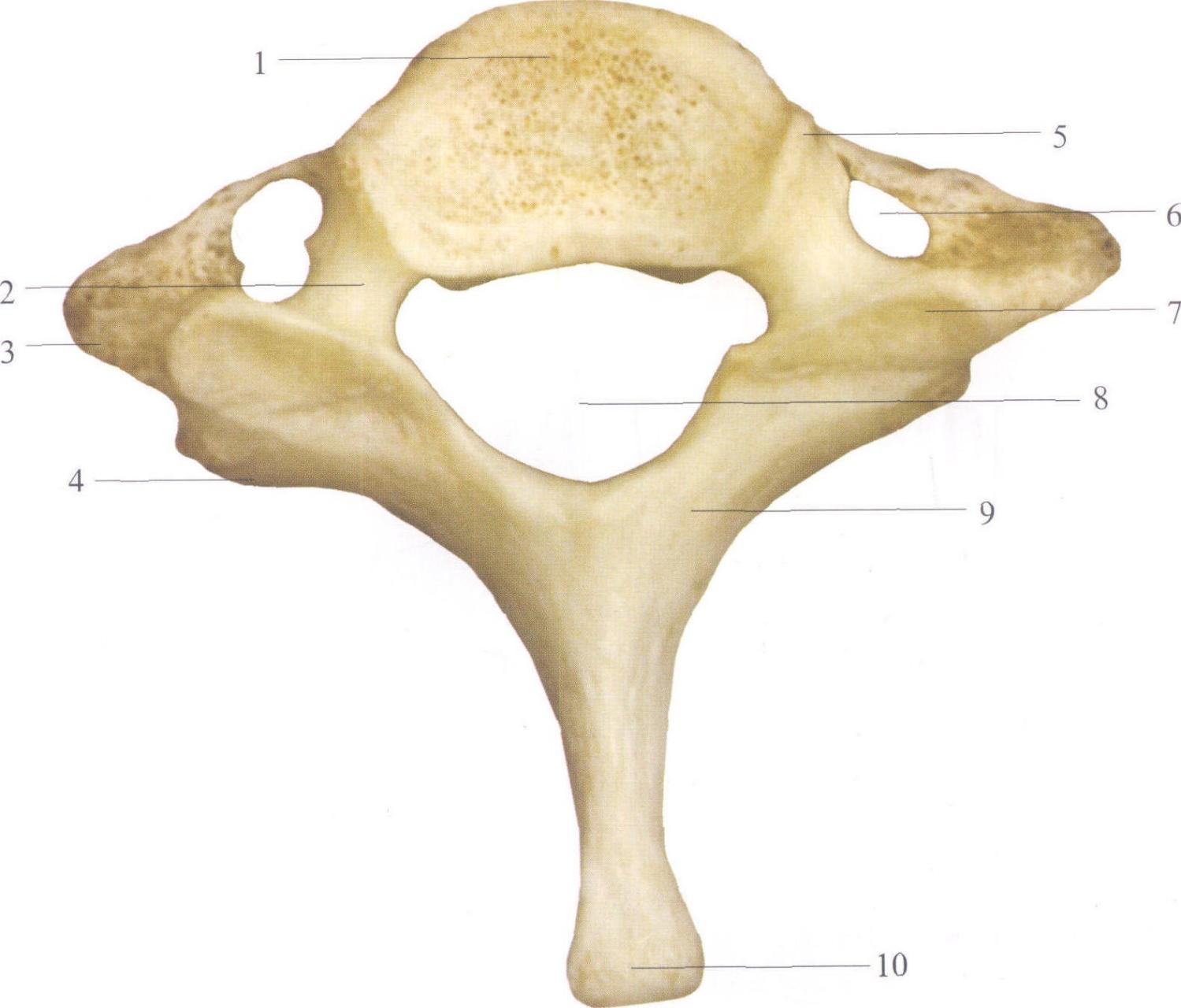 颈椎骨质增生会导致颈椎横突孔变窄,导致椎动脉血流供