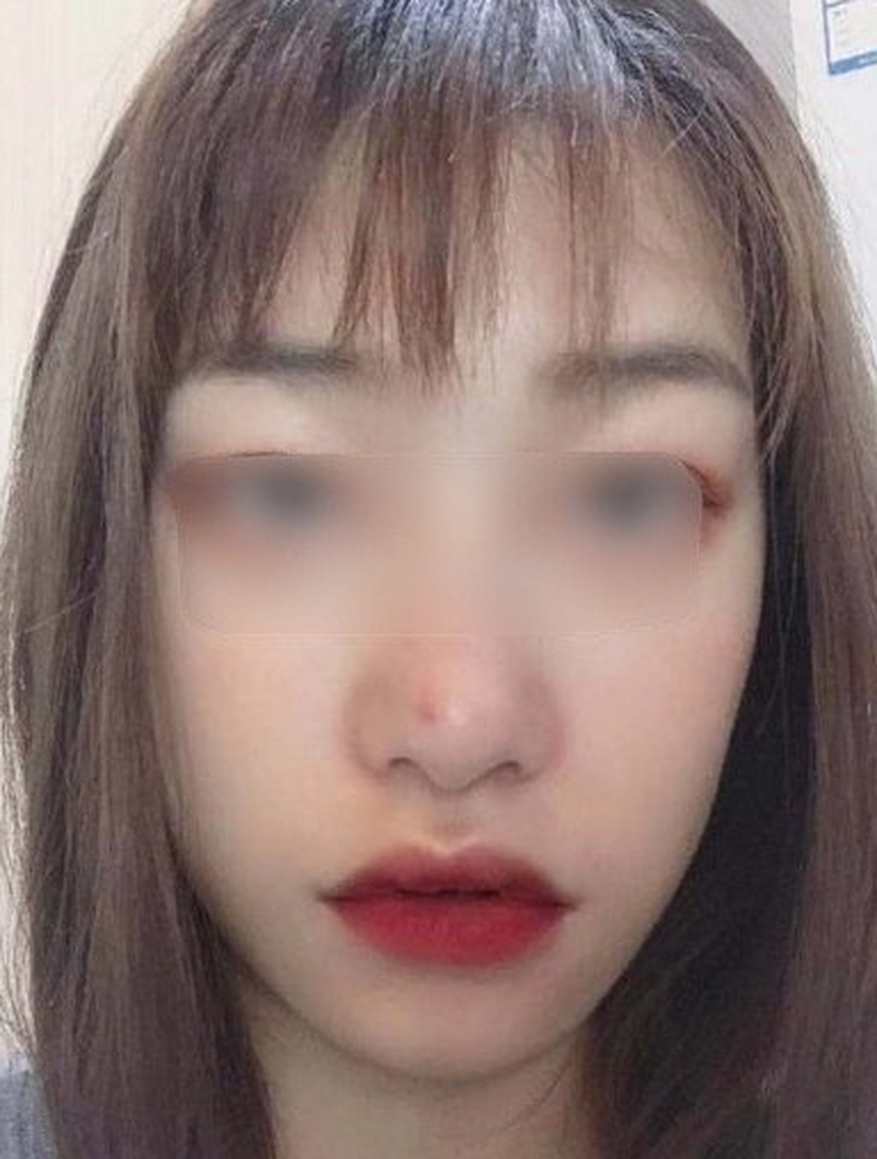 鲤鱼嘴的人 鲤鱼嘴就是嘴角两边是下垂的,这面相的人心肠很歹毒的