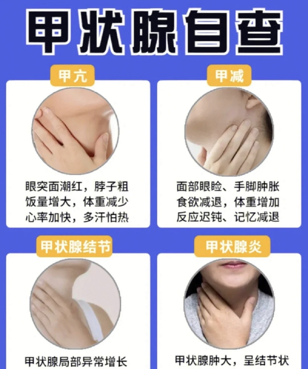 5张图让你看懂和自测自己是否有甲状腺问题,有甲状腺问题常见于那种