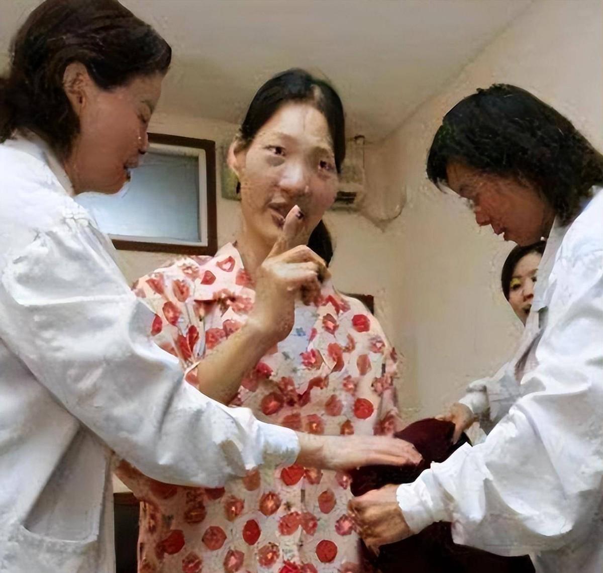 回顾中国女巨人:身高2.48米,一顿吃2斤,遗体至今封存完整