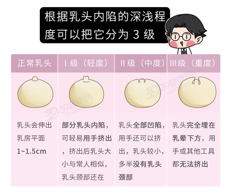 乳头内陷,该怎么办?