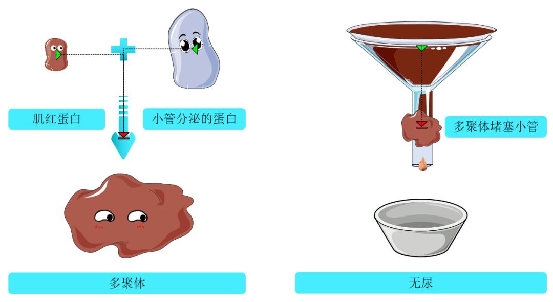 【鑫医话健康】揭秘运动后的"酱油尿"