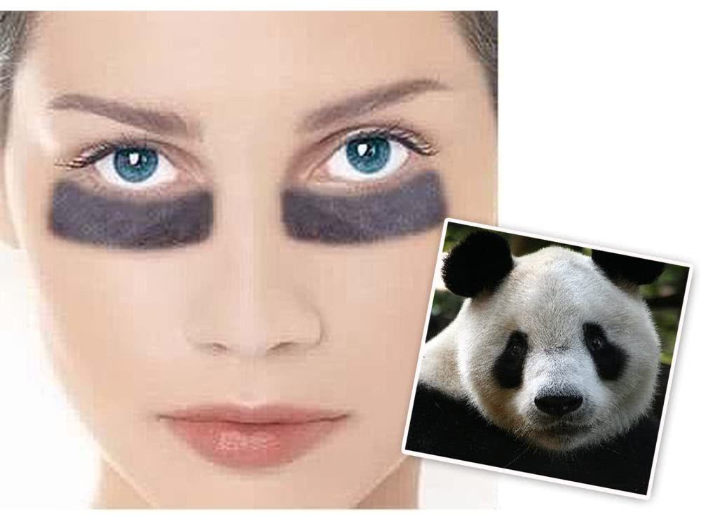 女性黑眼圈明显,可能是身体发出的信号,想要消除黑眼圈先治病