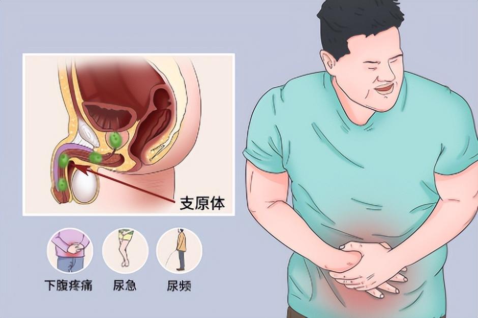 沙眼衣原體,生殖道感染的主要病原體,如何預防?