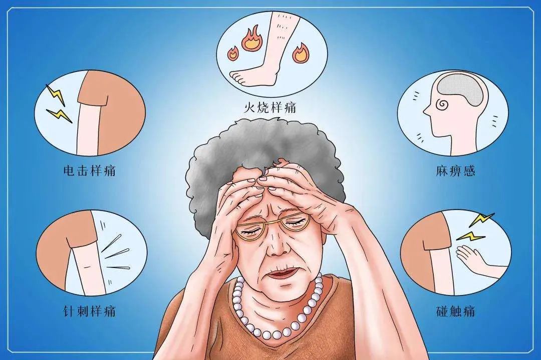 "完全好了,一点都不疼!"三叉神经痛折磨62岁老人2年多终康复