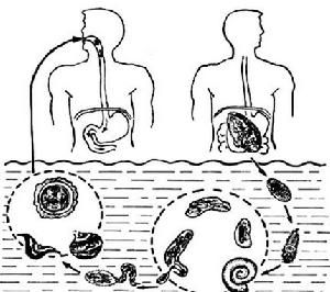 颚口线虫病是一种少见幼虫移植性疾病,会导致人体出现感染和炎症
