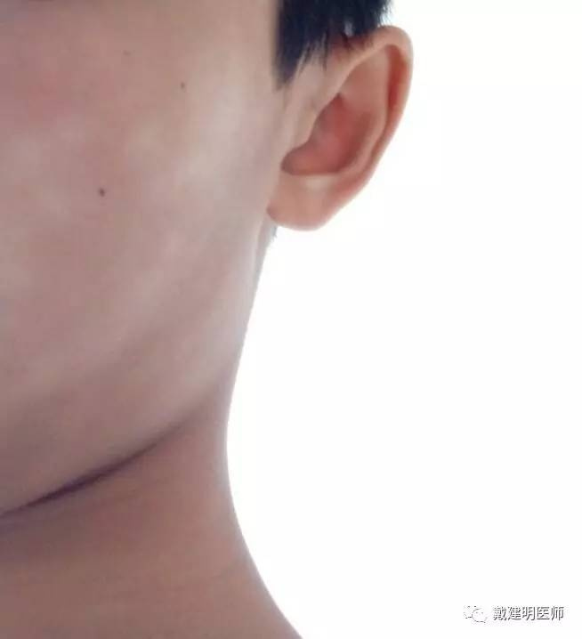 寄生虫病没有直接联系,在古代,卫生条件比较差,很多孩子都有寄生虫病