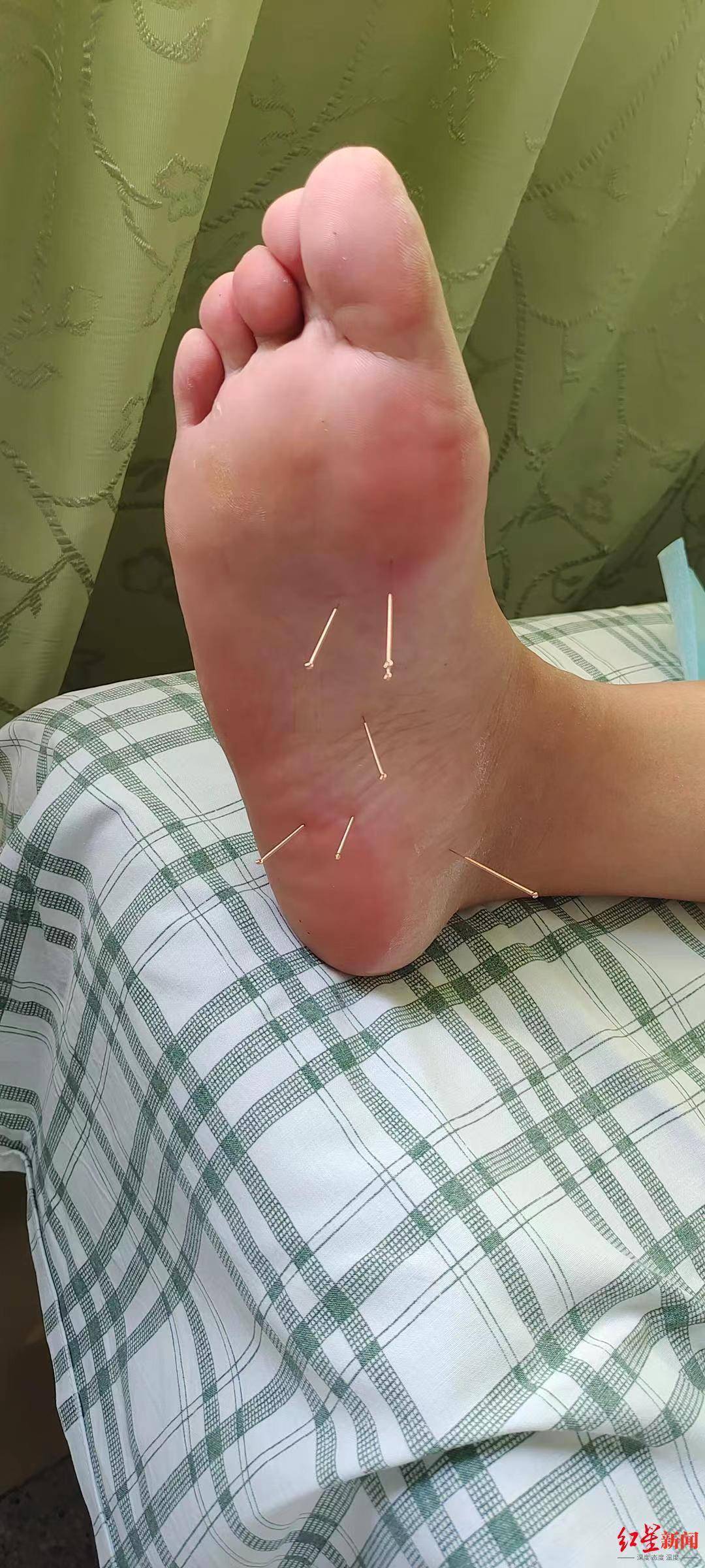 足底筋膜炎怎么办,脚撕裂般疼痛?脚跟不敢沾地,疼痛如何解决?