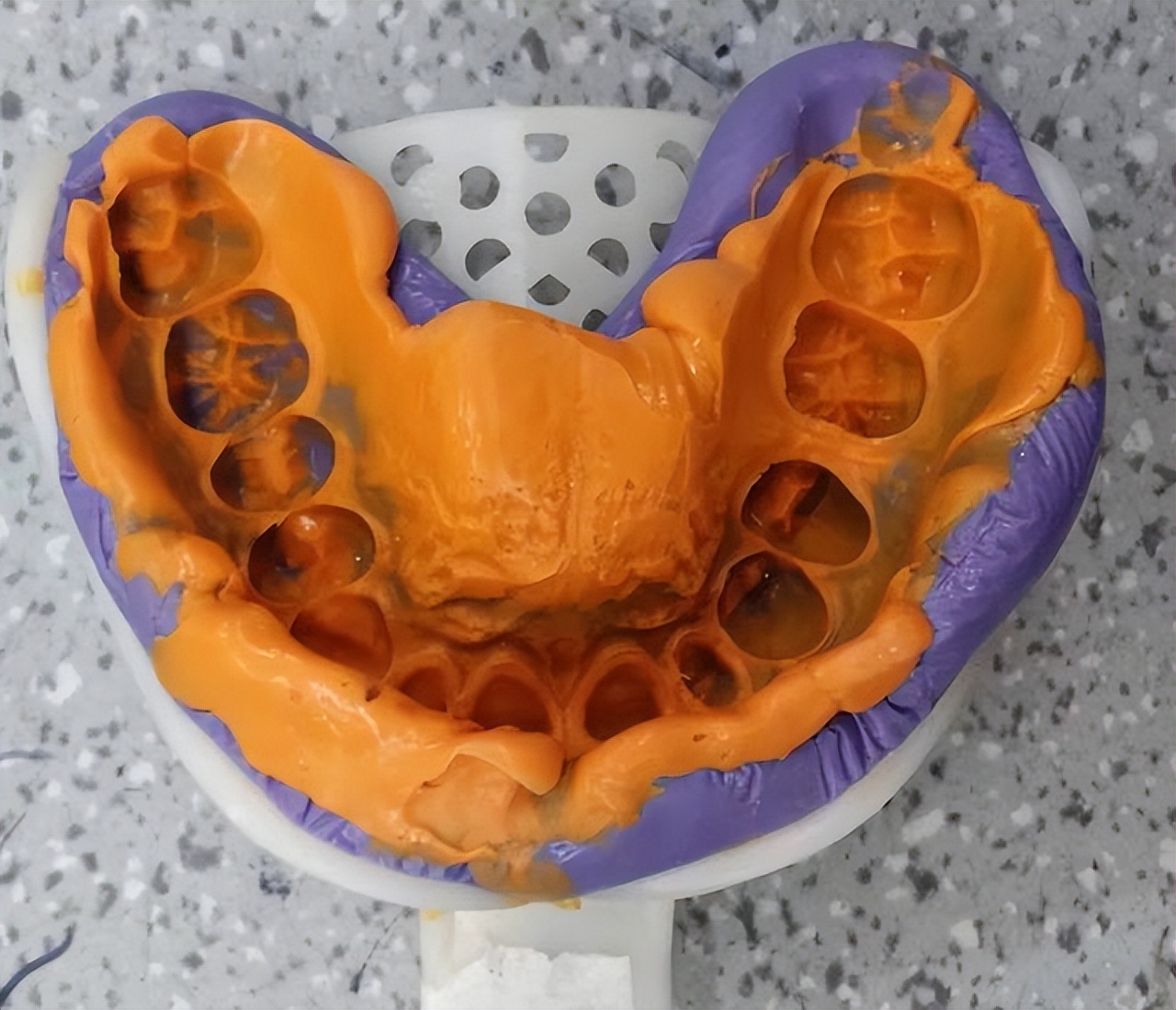 为什么要进行口腔取模?取模时嘴巴里含的是什么东西?