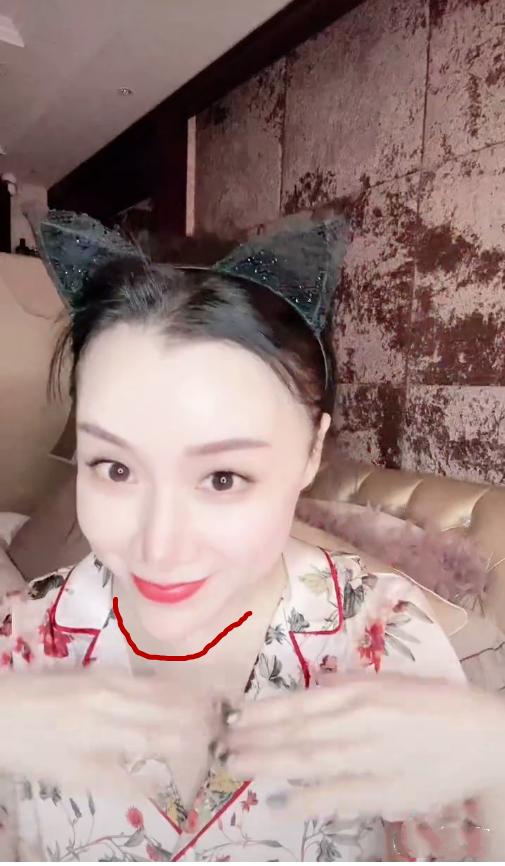 "国民媳妇"姚芊羽变样了?尖下巴似要戳穿屏幕,鼻头凸起显怪异