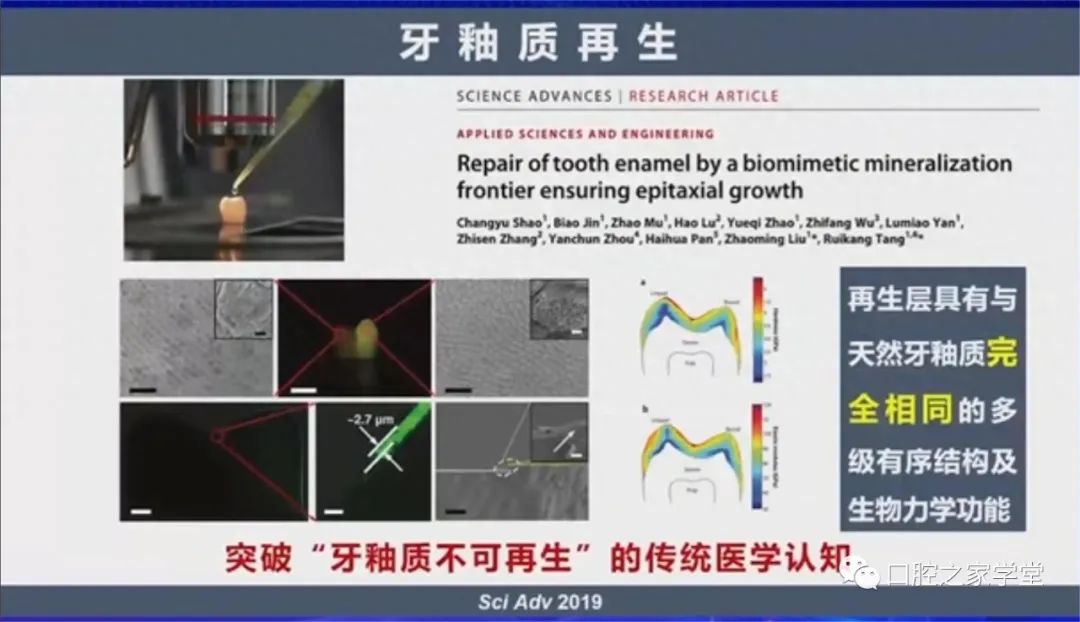 牙釉质生长液图片