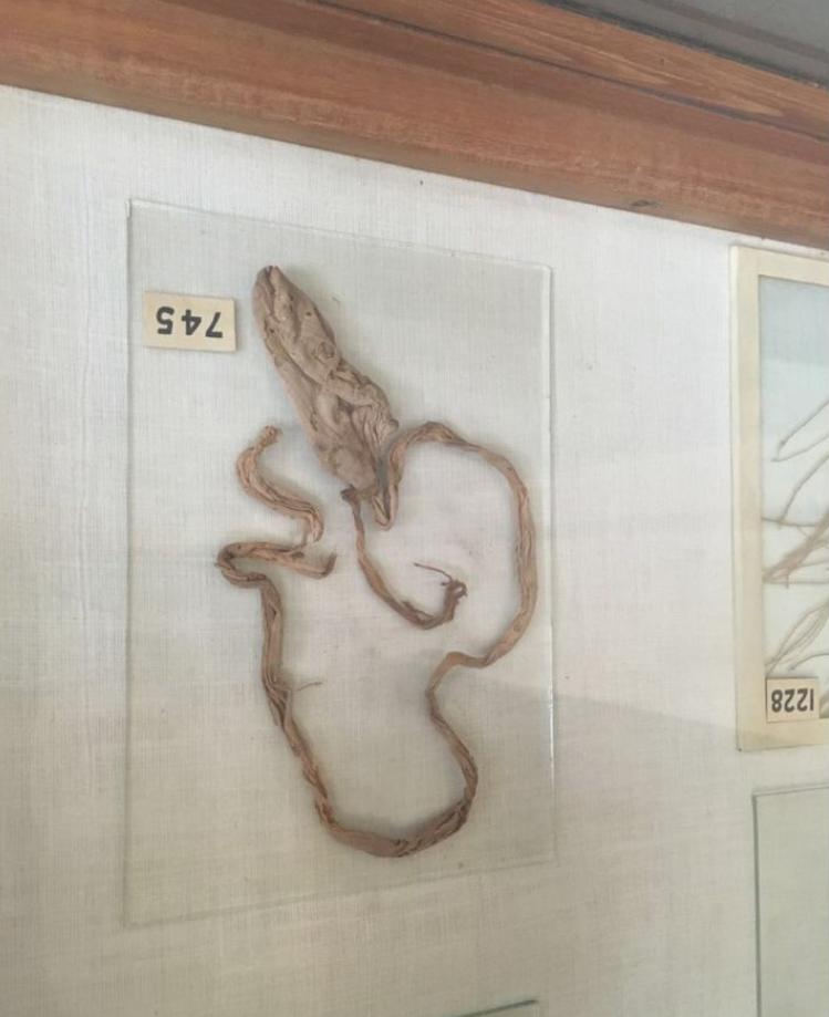 从亚麻,羊肠到橡胶,人类发明避孕套的路子究竟有多野?