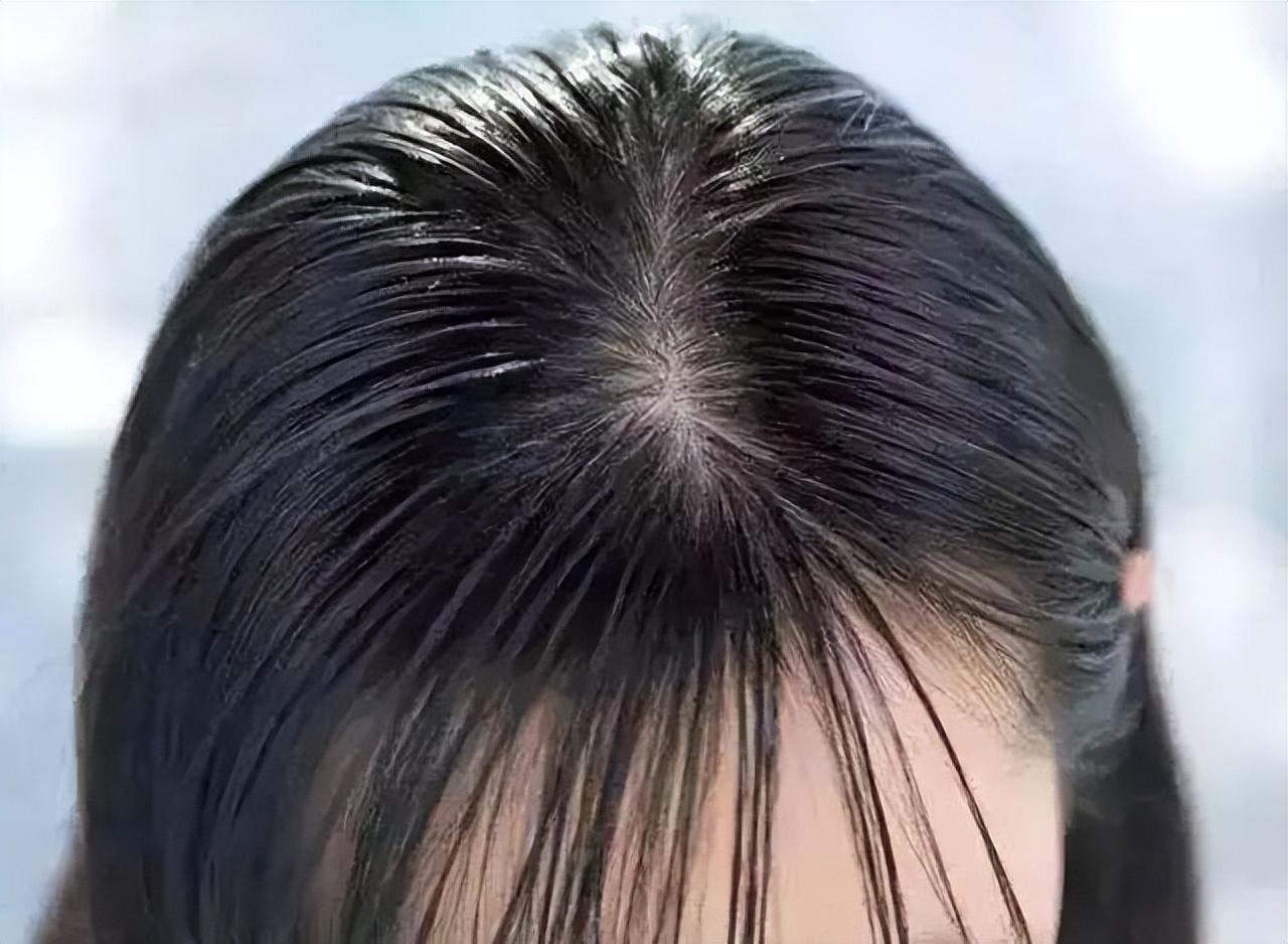 头发爱出油,可能跟这些习惯有关,头发甩掉油腻有三招