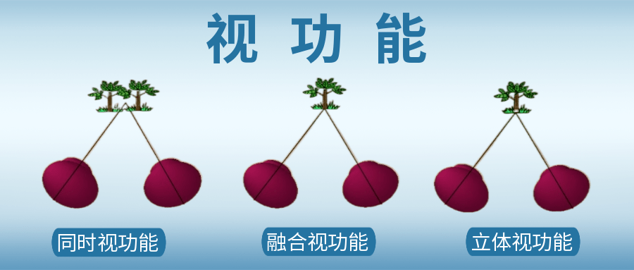 同时视,融合视,立体视……武汉普瑞眼科医生为您科普视功能